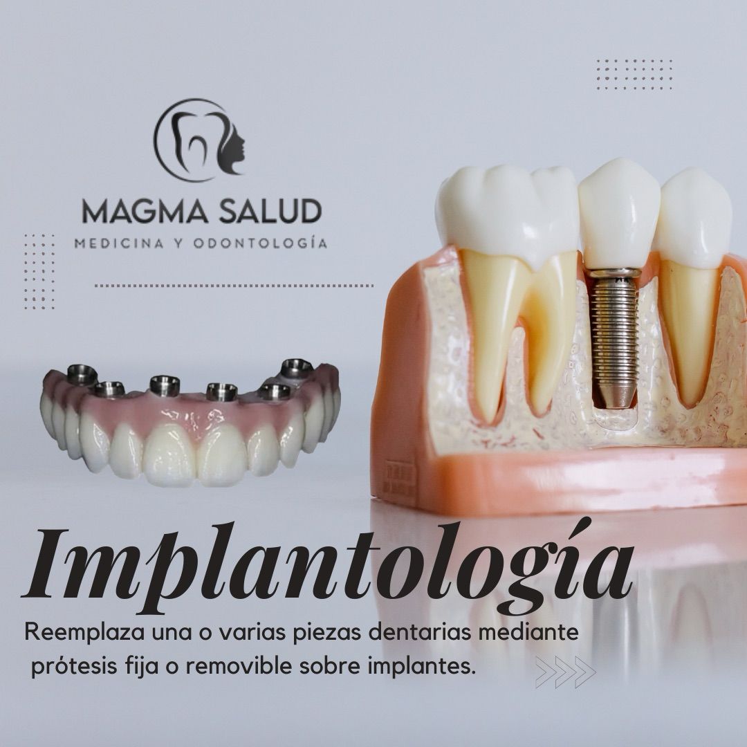 Implantologia
