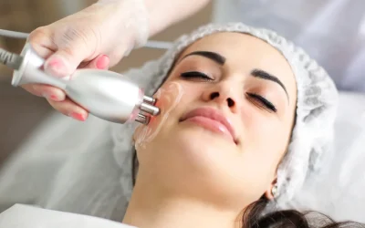 radiofrecuenciafacial